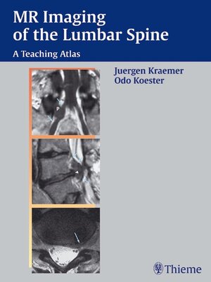 cover image of MR Imaging of the Lumbar Spine